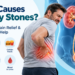 Kidney stone infographic showing a man with severe lower back pain, the kidneys and urinary tract, and common causes and symptoms including dehydration, high-salt diet, nausea, painful urination and blood in urine.